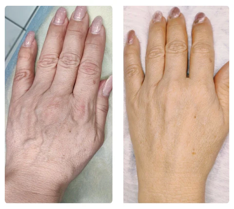 ATTDX Eggcellent SilkSkin Miracle Mask - Image 18