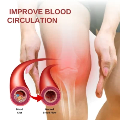 Fivfivgo™ Sehnen-Xanthomata Beruhigende Creme - Image 5