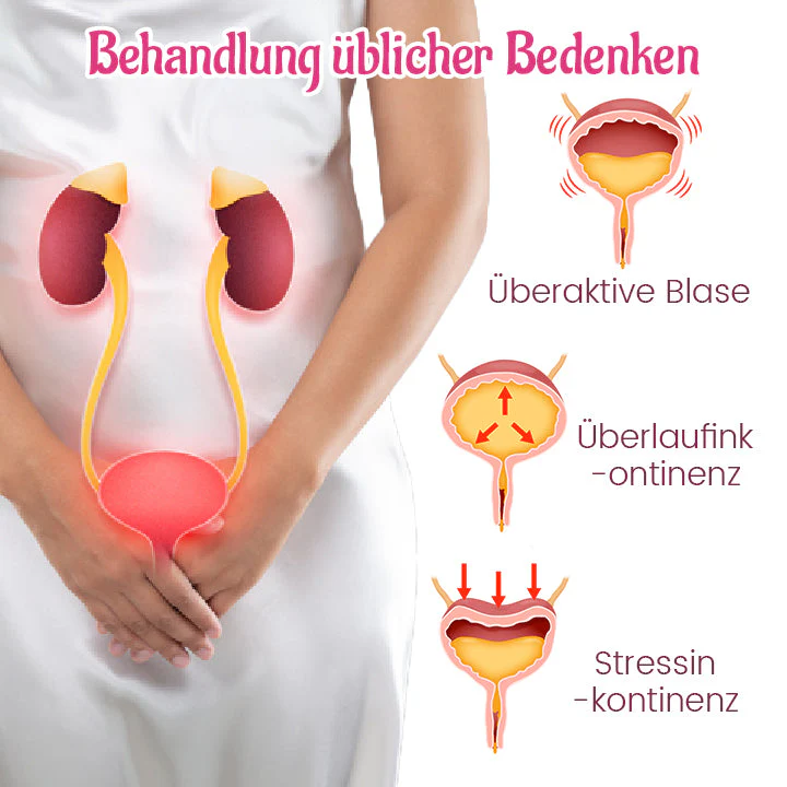 Biancat™ Blasenkontroll-Anti-Inkontinenz-Pflaster - Image 6