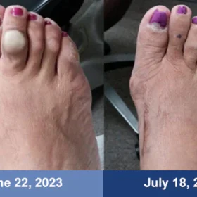 NORUION® Microcurrent EMS Therapy Bracelet - Image 8