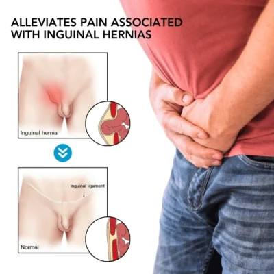 Oveallgo™ Inguinal Hernia Treatment Cream - Image 4
