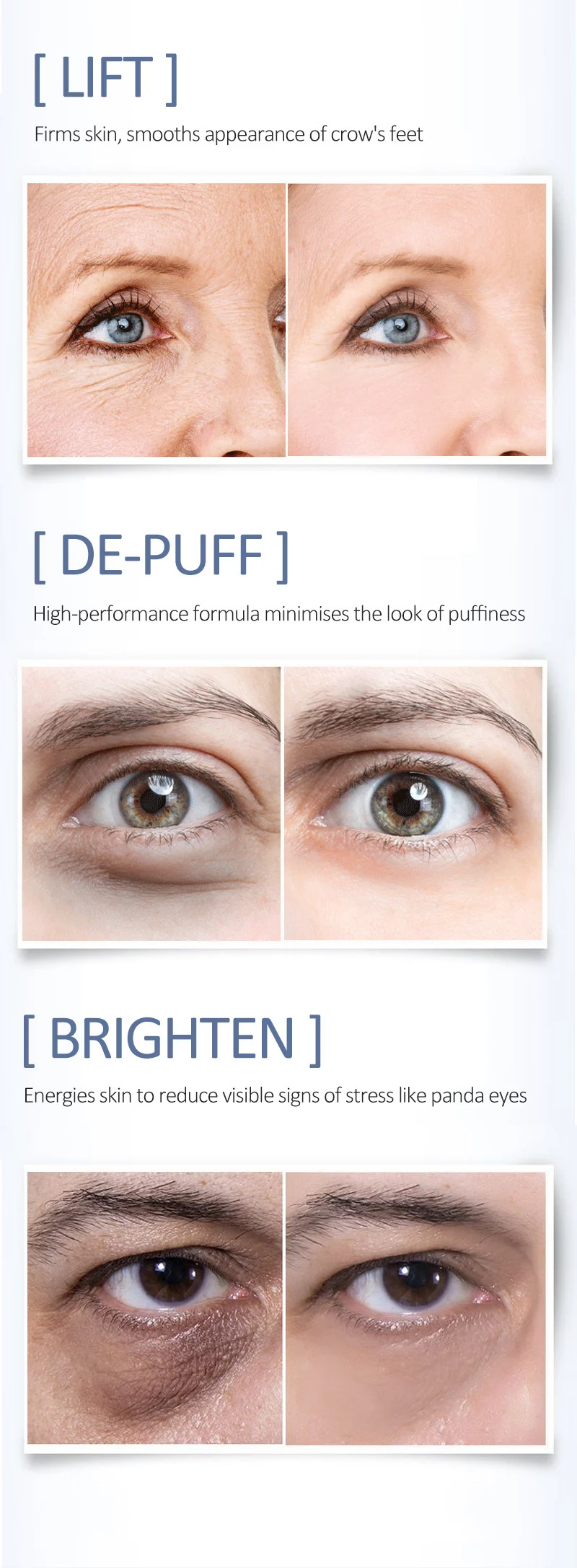 1+1 FREE | Auquest® | Treatment Hydrating Essence Eye Cream - Image 3