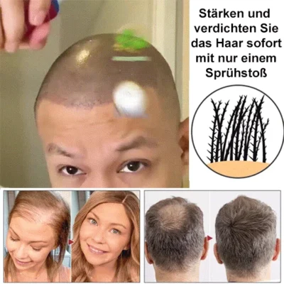 Natural Hair Regrowth Spray - Image 3