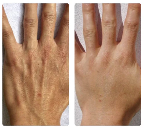 ATTDX Eggcellent SilkSkin Miracle Mask - Image 17