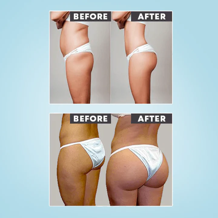 RtopR™ Mango Enhance Hip Cream - Image 8