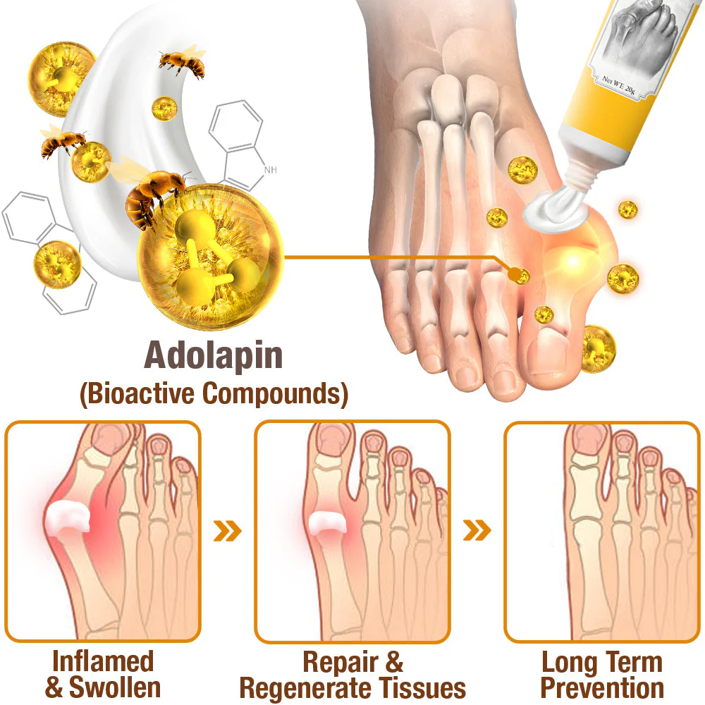 flysmus™ HalluxCare Bee Venom Treatment Cream - Image 5