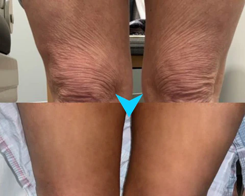 Seurico™ LuxeLift Skin Firming Youth Butter - Image 13