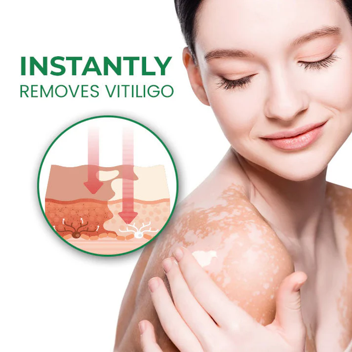 Lovilds™ VitiligoFix Revitalize Elixir - Image 11