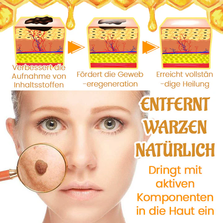 Biancat™ Bienenstich-Warzenpflegespray - Image 4