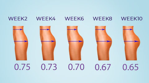 RtopR™ Mango Enhance Hip Cream - Image 6