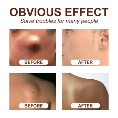 AQA™ Lipoma Soothing Cream - Image 3