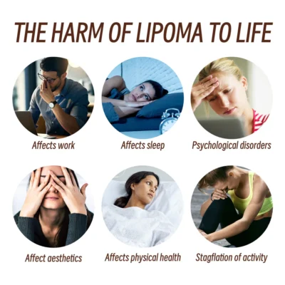 AQA™ Lipoma Soothing Cream - Image 10