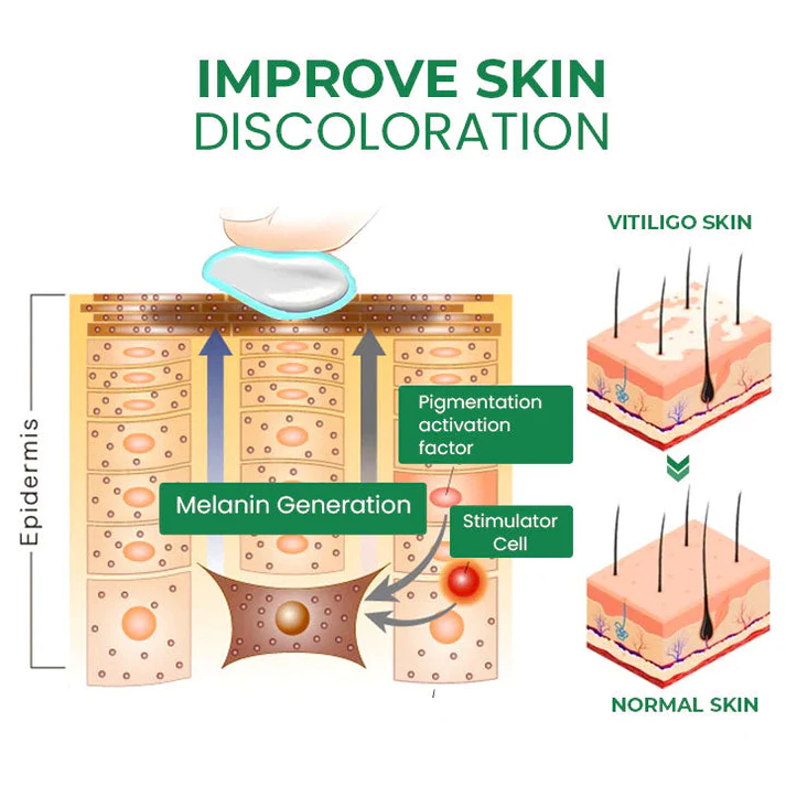 Lovilds™ VitiligoFix Revitalize Elixir - Image 10