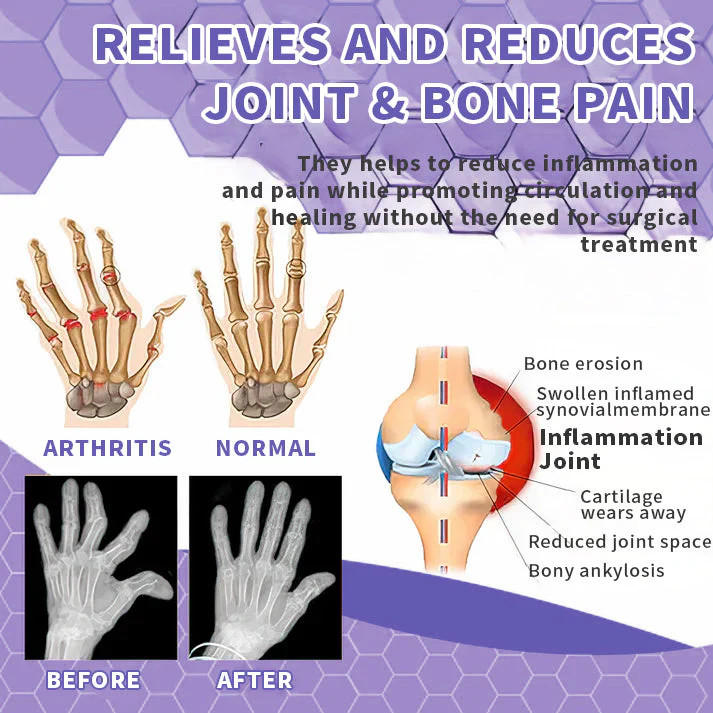 Seurico™ Snake Venom Joint Therapy Pain Relief Gel - Image 6