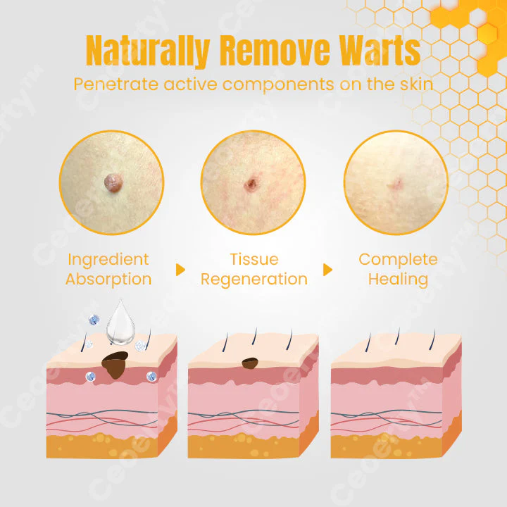 Ceoerty™ TagOUT Bee Venom Treatment Spray - Image 4