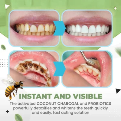 LIMETOW™ FreshPlus Bee Venom Ampoule Toothpaste - Image 9