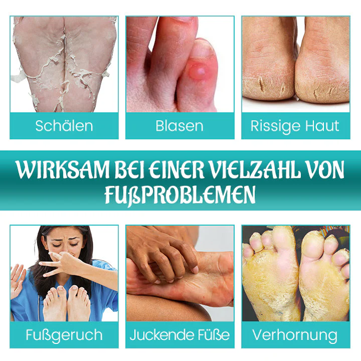 Biancat™ FreshStride Fortschrittliches Antitranspirant Fußpflegespray - Image 7