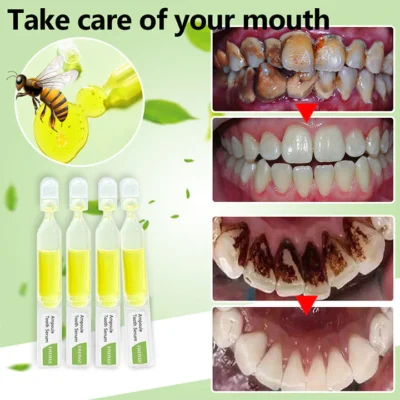 LIMETOW™ FreshPlus Bee Venom Ampoule Toothpaste - Image 8