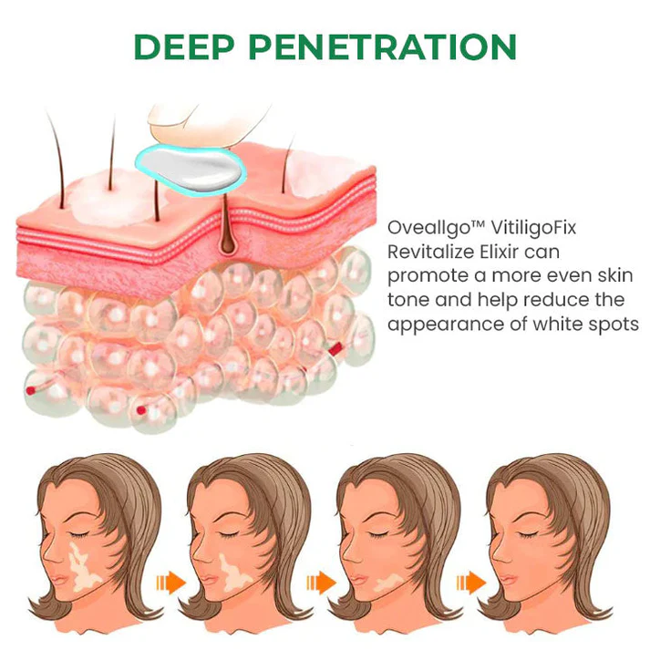 Lovilds™ VitiligoFix Revitalize Elixir - Image 9