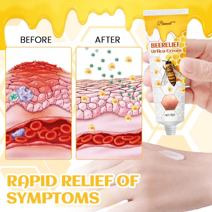 Biancat™ BeeRelief Urtica Creme - Image 6