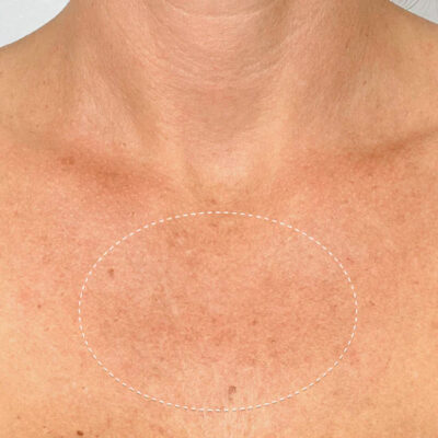 ODEIUN™ Ultra Renewal Retinol Body Cream - Image 4