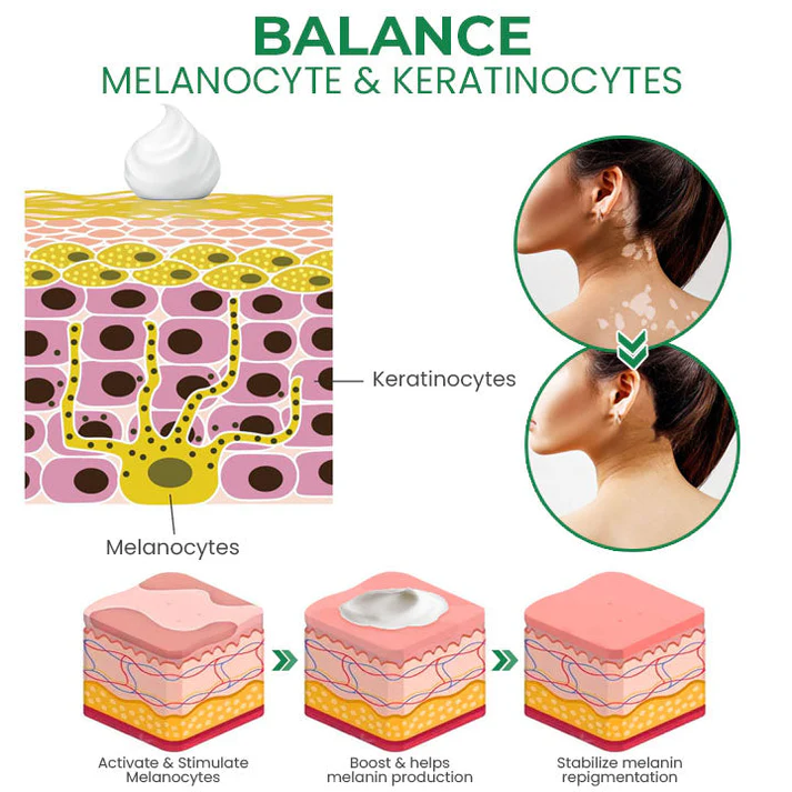 Lovilds™ VitiligoFix Revitalize Elixir - Image 6