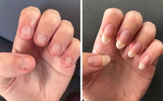 Biancat™ FungiFix Nagelpilz-Pflegefluid - Image 5