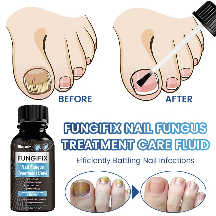 Biancat™ FungiFix Nagelpilz-Pflegefluid - Image 4