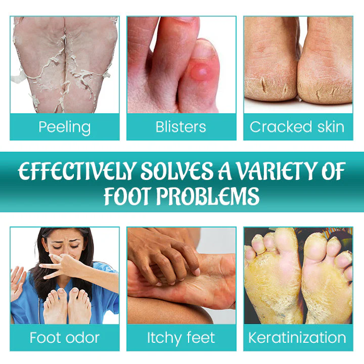 Biancat™ FreshStride Advanced Antiperspirant Foot Care Spray - Image 3