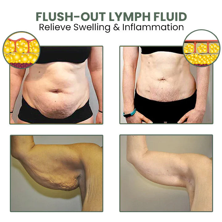 Fivfivgo™ Wermut CelluliteWegMit Hautstraffungscreme - Image 6