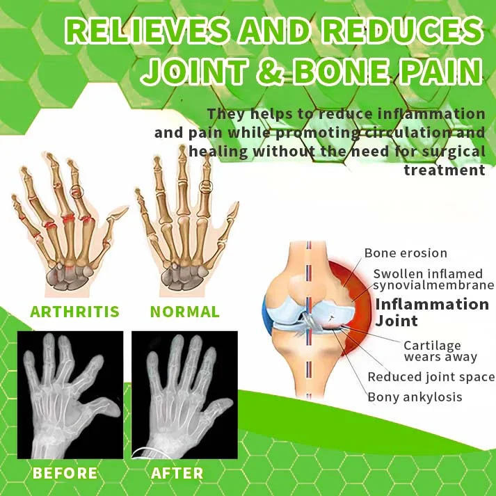 Seurico™ Cannabidiol Professional Joint Gel Therapy - Image 4