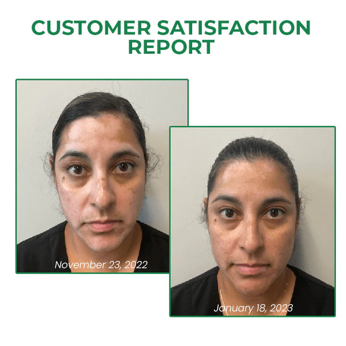 Lovilds™ VitiligoFix Revitalize Elixir - Image 4