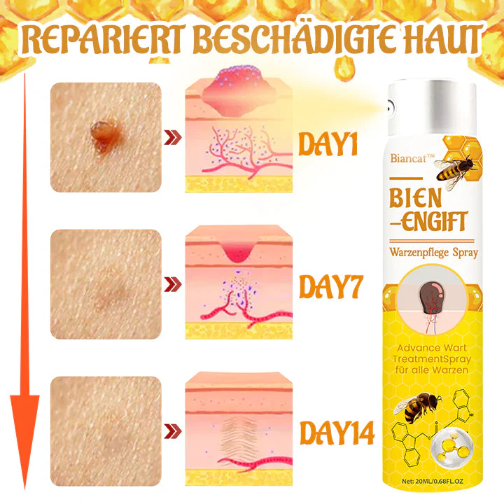 Biancat™ Bienenstich-Warzenpflegespray - Image 6