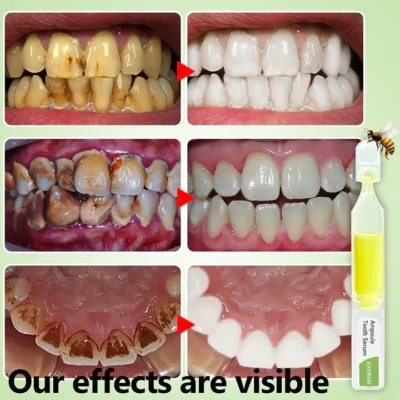 LIMETOW™ FreshPlus Bee Venom Ampoule Toothpaste - Image 5