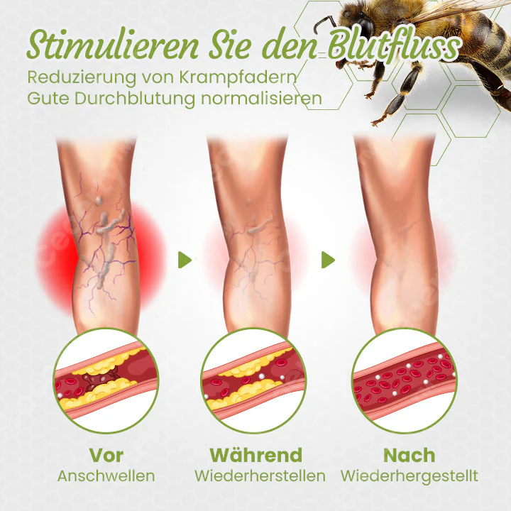 Ceoerty™ LymphaCare Bienengift-Einweichperlen - Image 4