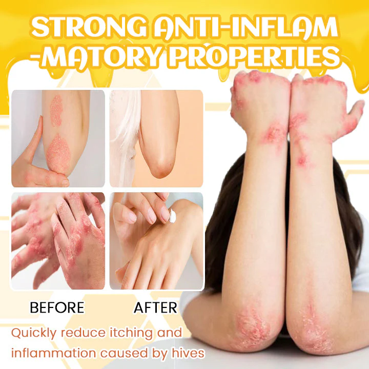 Biancat™ BeeRelief Urtica Creme - Image 3