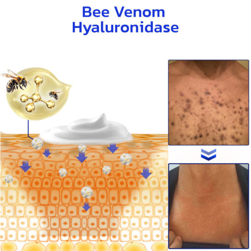 Furzero™ NonSpot Bee Venom Pigment Correction Cream - Image 12