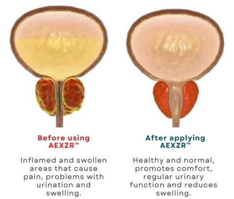AEXZR™ Prostate Care Point Clip - Image 14