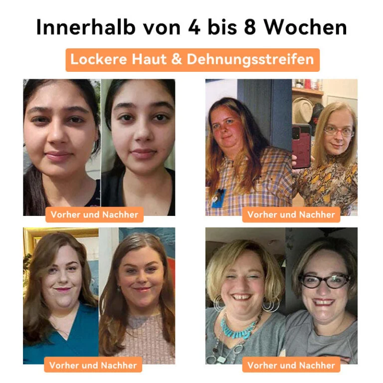 π
πππππβ’ ππ’ππ§ππ§π π’ππ ππ²π¦π©π‘ππ«ππ’π§ππ π πππ‘π₯ππ§π€π‘ππ’ππ¬π©ππ₯ππ¬πππ« - Image 7