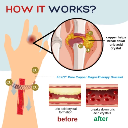 AEXZR™ Pure Copper MagneTherapy Bracelet - Image 8