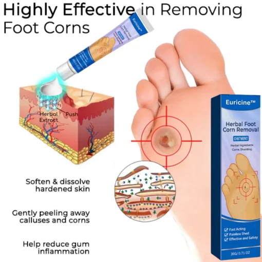 Euricine™ Herbal Foot Corn Removal Ointment - Image 6