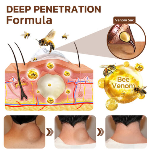 GFOUK™ Maryanni Bee Venom Lymphatic Recovery Cream - Image 9