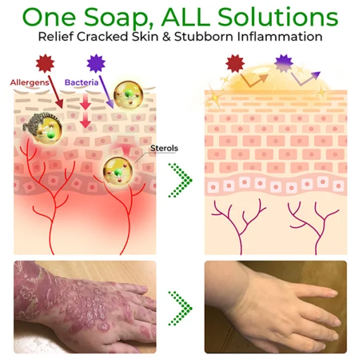 GFOUK™ Crócil Crocodile Oil Repair Aleppo Soap - Image 8