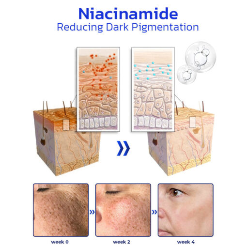 Furzero™ NonSpot Bee Venom Pigment Correction Cream - Image 11