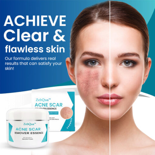 ZebQua™ Acne Scar Remover Essence - Image 4