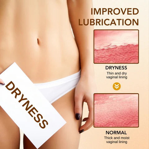 Oveallgo™ Bee Venom NMN Natural Repair Vaginal Capsules - Image 5