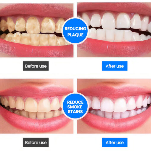 Unpree™ SP-4 Probiotic Whitening Toothpaste - Image 10