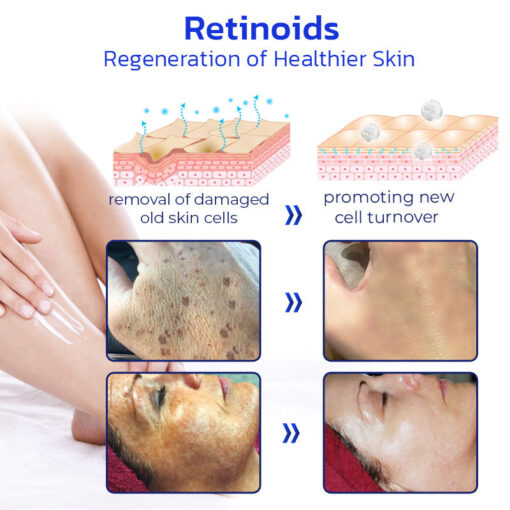 Furzero™ NonSpot Bee Venom Pigment Correction Cream - Image 8