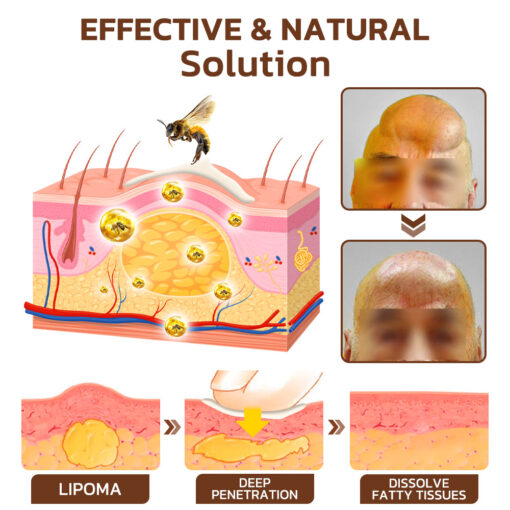 GFOUK™ Maryanni Bee Venom Lymphatic Recovery Cream - Image 6