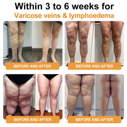 YAGOO™ Nano-Ion Fat-Burning Icy Silk Shapewear - Image 7